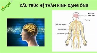 Khuyết Tật Về Thần Kinh Là Gì